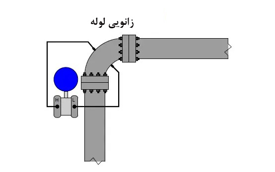 زانویی